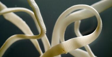 insan vücudundan çıkan düz parazit